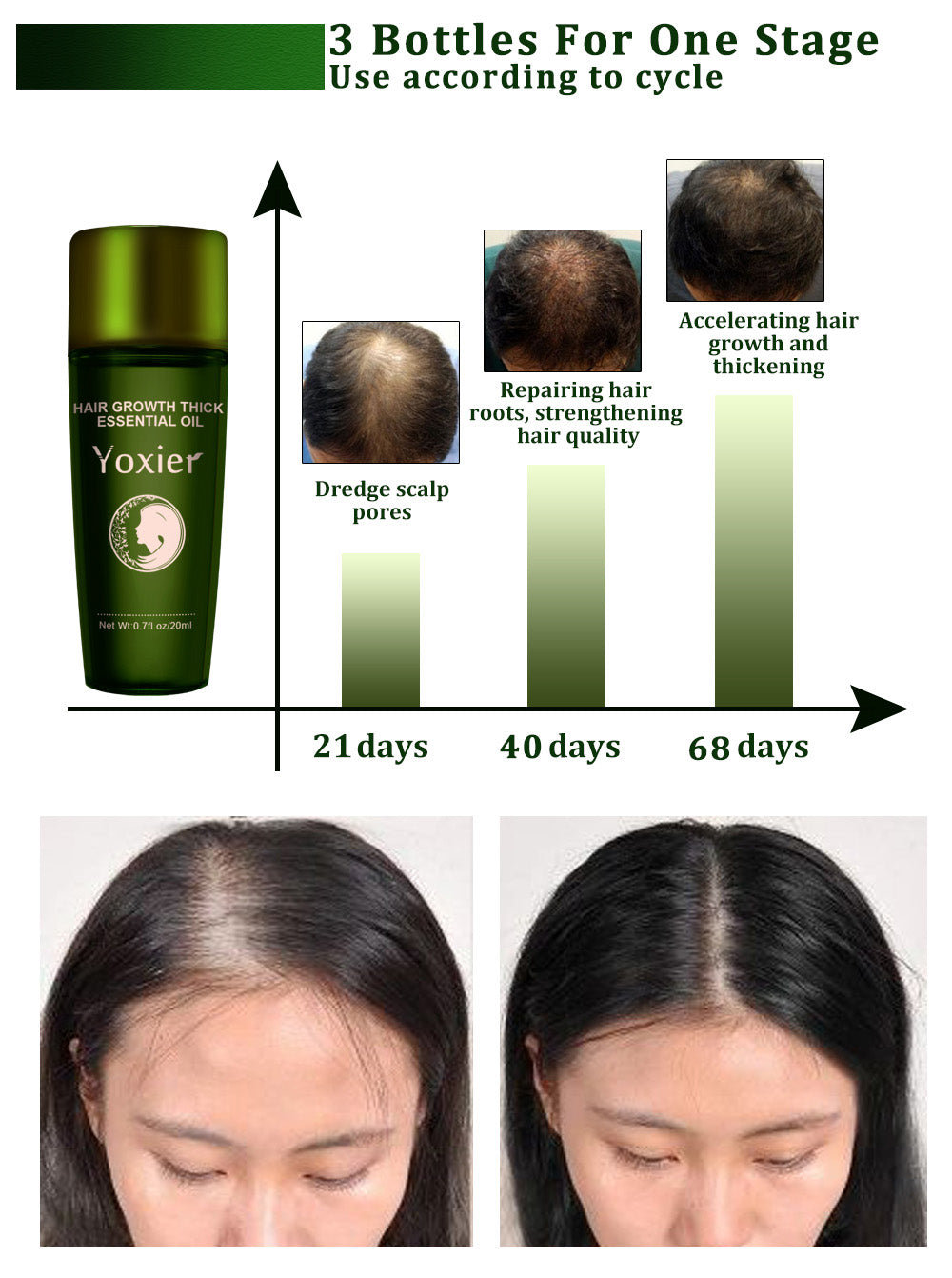 huile LUMINA : trois bouteilles pour la croissance des cheveux, avant et après utilisation sur 68 jours.