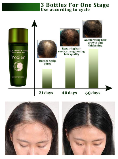 huile LUMINA : trois bouteilles pour la croissance des cheveux, avant et après utilisation sur 68 jours.